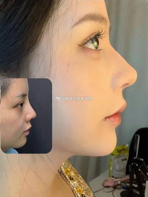 青岛博美医疗美容诊所价格表