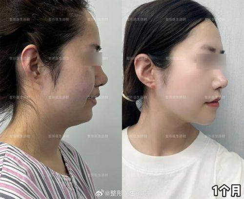 徐州王医生美容整形医院价格表: