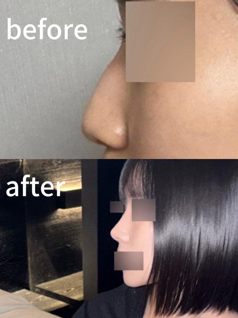 深圳丽格云发医疗美容诊所擅长项目：