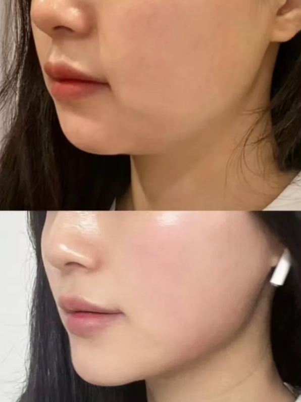 宁波舒禾医疗美容诊所怎么样？