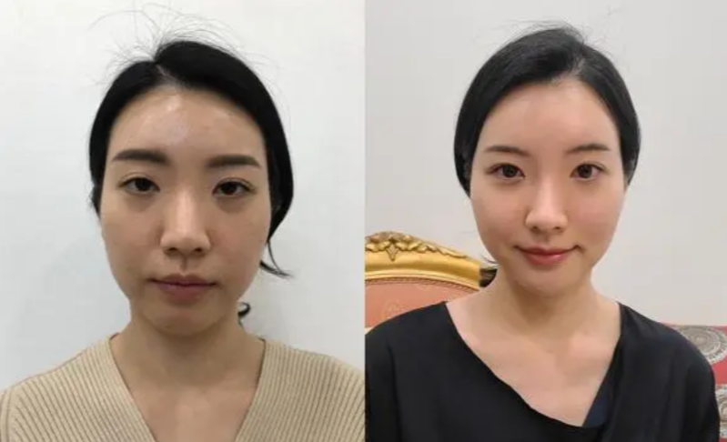 昆明肌妍医疗美容诊所擅长项目：