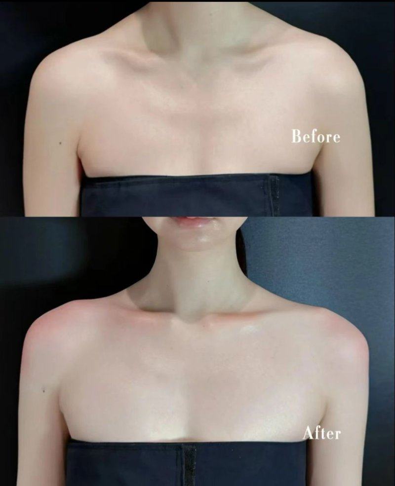 四、特殊疤痕的修复时间选择