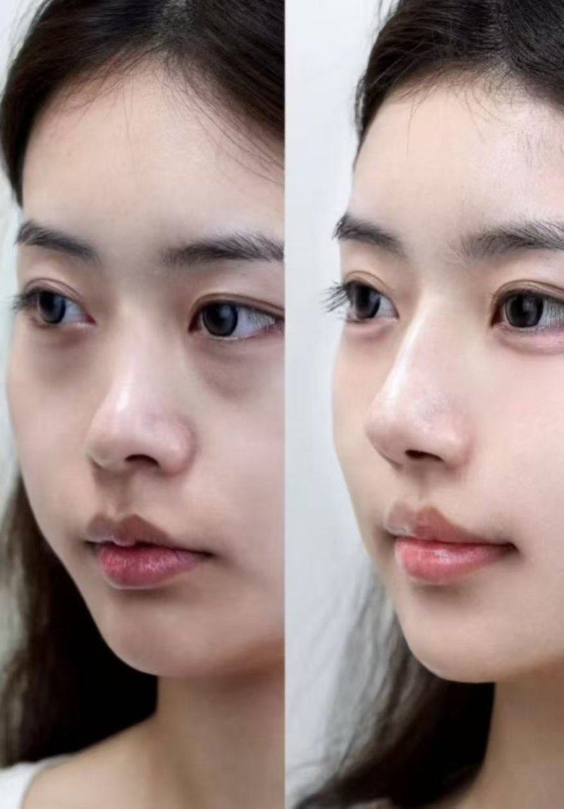 成都MYSKIN医疗美容诊所怎么样？