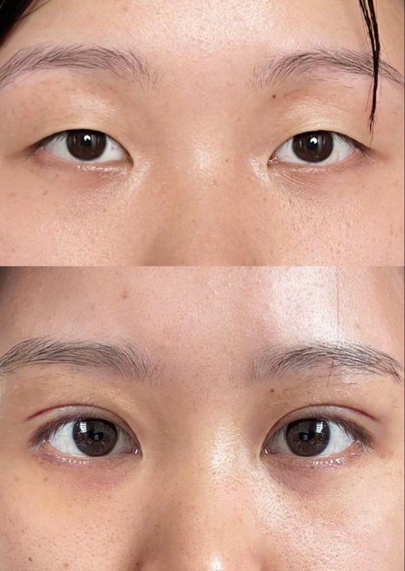 青岛华颜美医疗整形医院价格表：