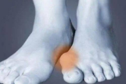 四、睫毛种植的美观与功能双重成效