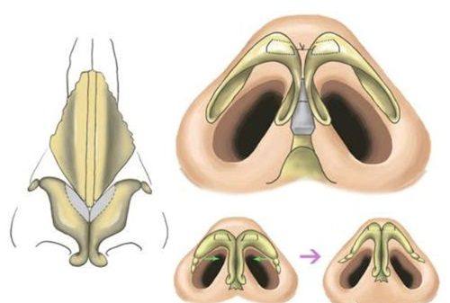 绵阳茗汇整形医院怎么样？