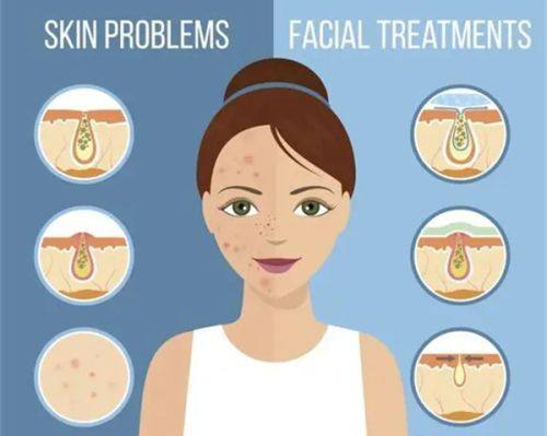 五、超声波去眼袋的价格参考与靠谱机构选择