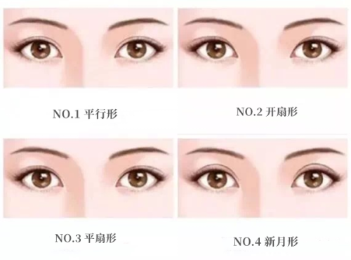 二、超声波去眼袋的真实成效如何