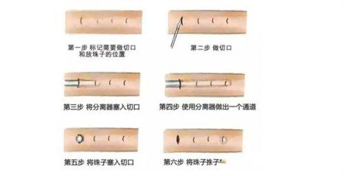 二、头发种植的针对性改善成效