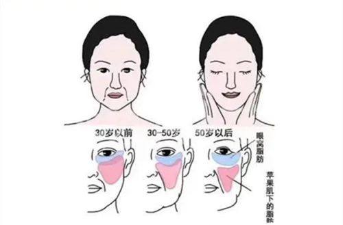 五、术后避坑护理:把副作用扼杀在摇篮里