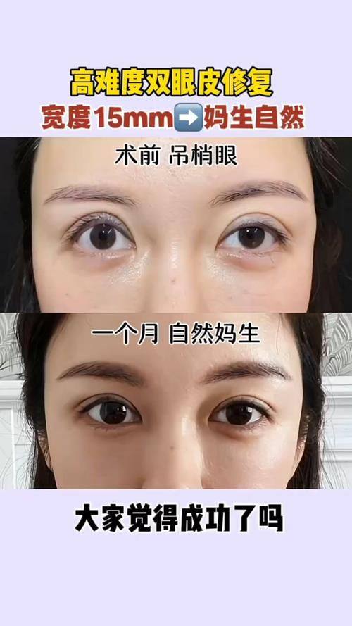 重庆科妍玑整形医院价格表: