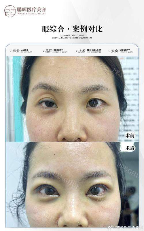 东莞仁康医院整形外科口碑评价: