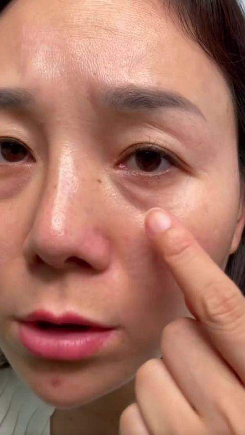 东莞仁康医院整形外科擅长项目: