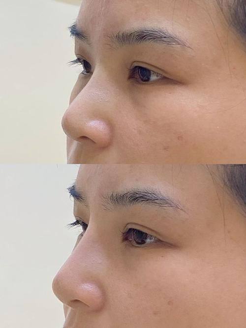 呼和浩特韩赋医疗美容擅长项目