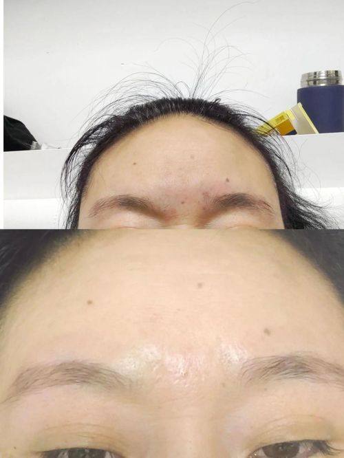 绵阳茗汇整形医院擅长项目：