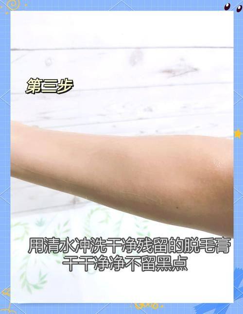 北京中关村医院激光整形美容医院价格表：