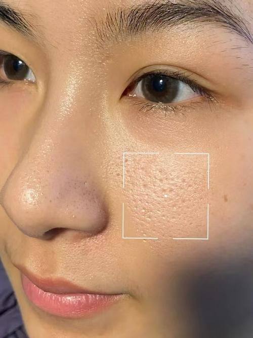 刘崇林医生口碑评价