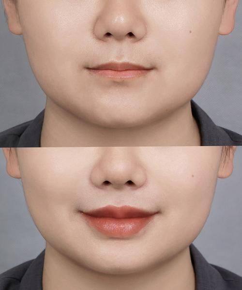 北京佳妍整形医院地址电话及营业时间