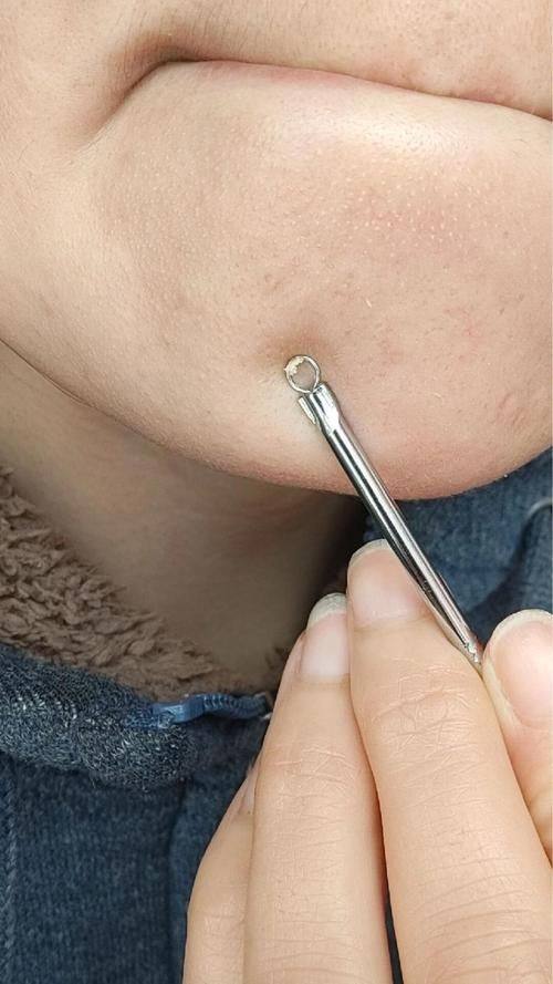 刘崇林医生怎么预约