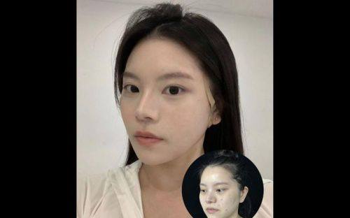 呼和浩特韩赋医疗美容医生名单及擅长领域