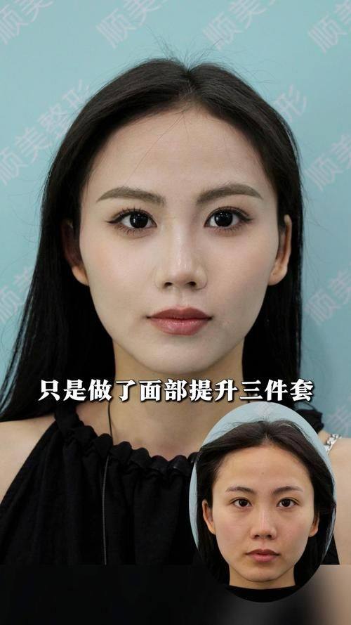 北京中关村医院激光整形美容医院口碑评价：