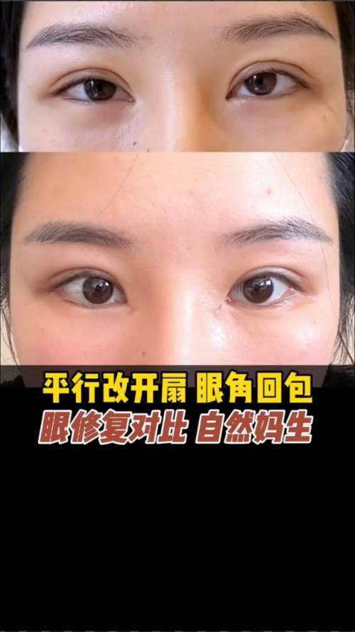 亳州东方美莱坞整形医疗美容医院怎么样？