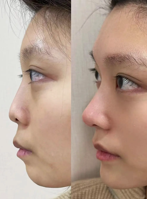 北京佳妍整形医院怎么样?