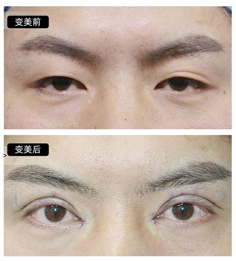 四、专精机构与医生推荐：保护修复成效