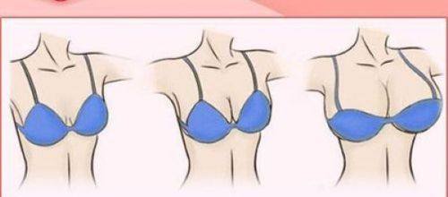 陈越文医生技术优势