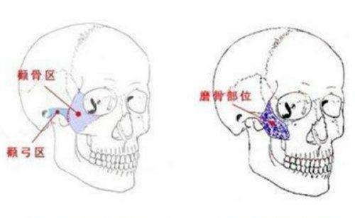 五、华美祛眼袋的核心优势：技术与服务双驱动