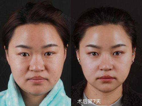 宜宾宜美医学美容整形诊所预约挂号方式