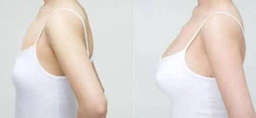 杭州艺然美医疗美容门诊部价格表