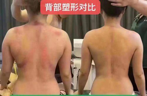 任彦俊医生技术优势