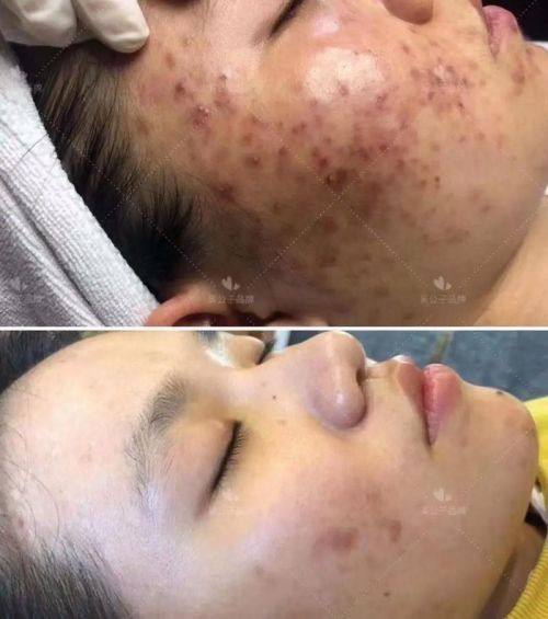 嘉峪关市韩美尔整形医院口碑评价