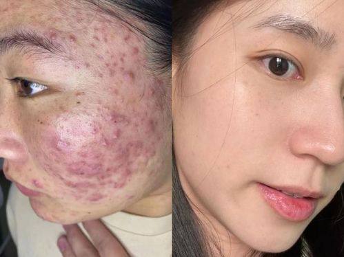 杭州艺然美医疗美容门诊部口碑评价