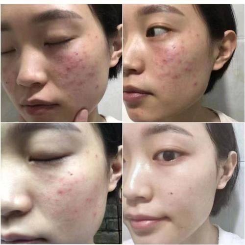 杭州艺然美医疗美容门诊部地址电话及营业时间