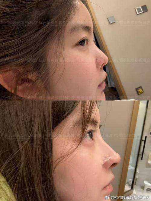 嘉峪关市韩美尔整形医院医生名单及擅长领域