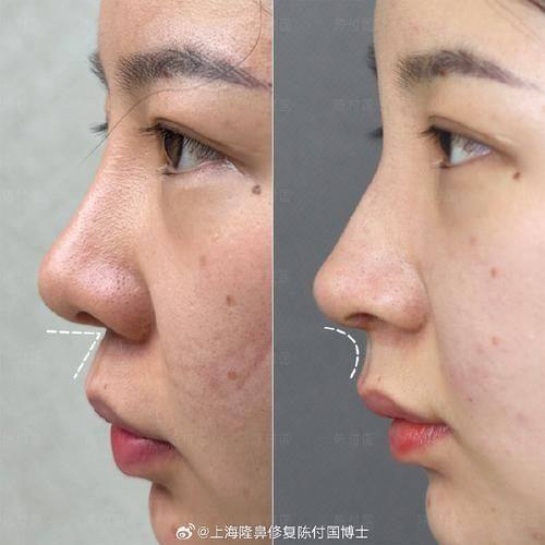 宜宾宜美医学美容整形诊所价格表