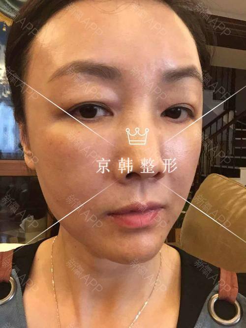 葫芦岛元辰整形医院预约挂号方式