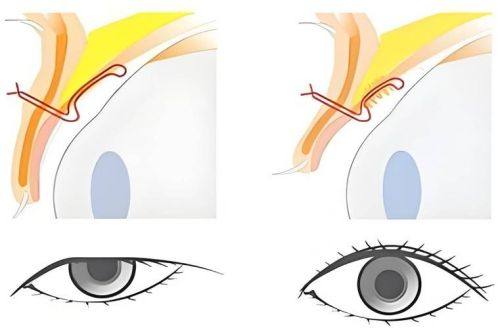 内浦康信医生擅长领域
