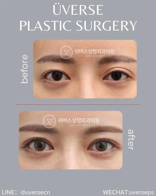 陈越文医生口碑评价