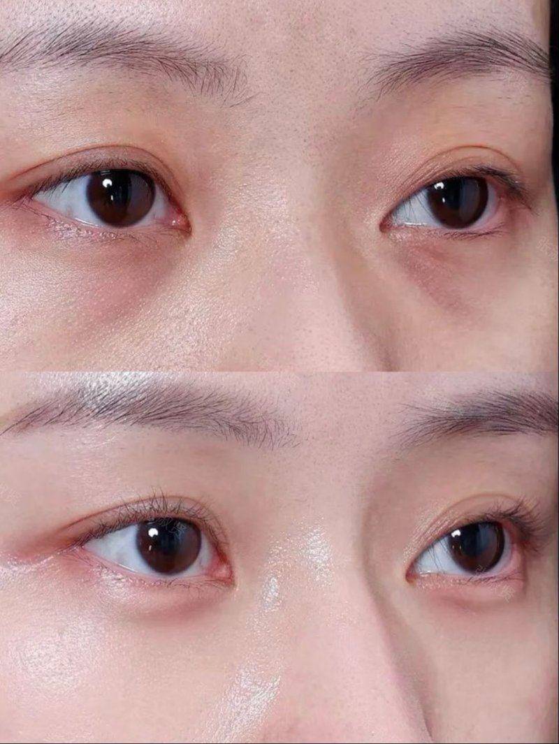 二、吸脂暗藏的医疗安心类风险