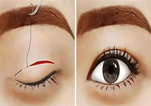 北京丽星翼美医疗美容擅长项目