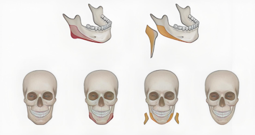 合肥包河区疾病防控中 心擅长项目:
