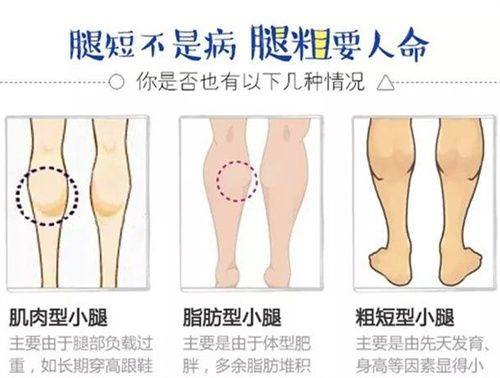 四、双眼皮改回单眼皮(双改单)的可行性与细节