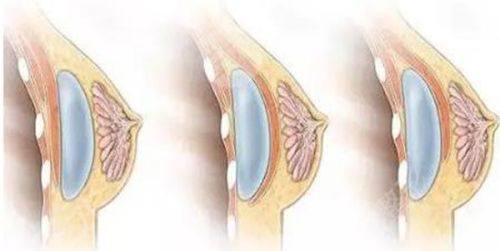 五、其他常见术后问题的修复策略