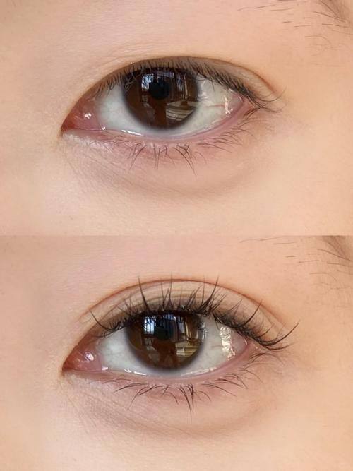 北京美耀天下医疗美容怎么样？