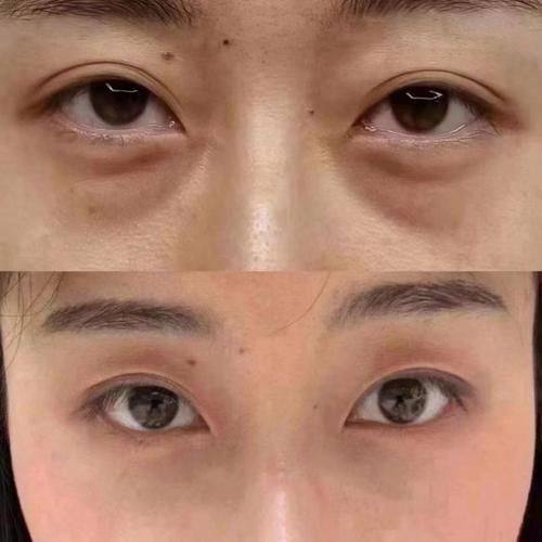 郭兴显医生口碑评价