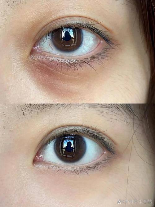 郭兴显医生技术优势