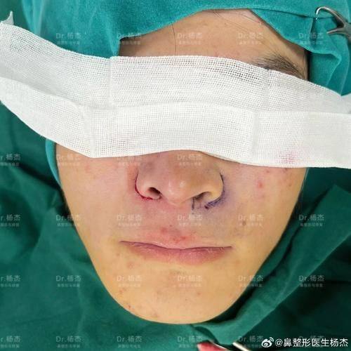 惠州惠阳丽港医疗美容门诊部怎么样？